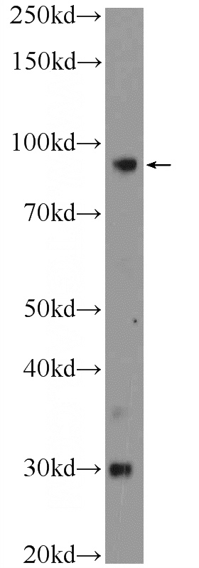 human plasma tissue were subjected to SDS PAGE followed by western blot with Catalog No:113925(PLA2G4B Antibody) at dilution of 1:300