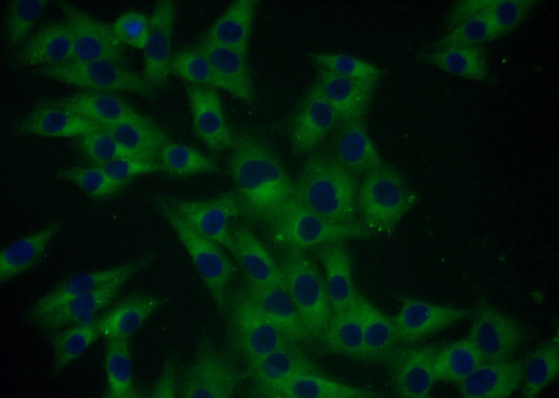 Immunofluorescent analysis of A375 cells using Catalog No:108887(Cathepsin B Antibody) at dilution of 1:25 and Alexa Fluor 488-congugated AffiniPure Goat Anti-Rabbit IgG(H+L)