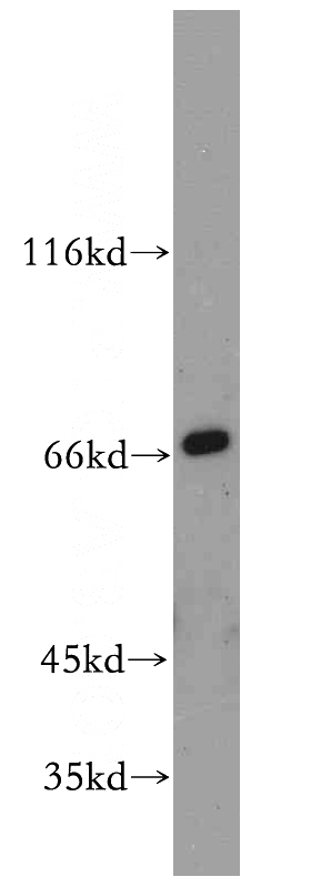 mouse brain tissue were subjected to SDS PAGE followed by western blot with Catalog No:114537(RANBP10 antibody) at dilution of 1:300