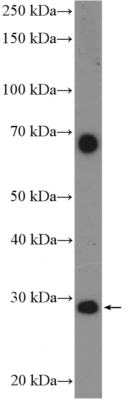 mouse brain tissue were subjected to SDS PAGE followed by western blot with Catalog No:108074(ANKRD29 Antibody) at dilution of 1:300
