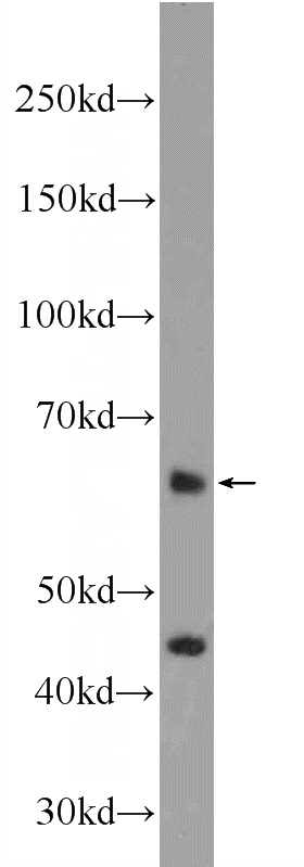 mouse testis tissue were subjected to SDS PAGE followed by western blot with Catalog No:116998(ZNF497 Antibody) at dilution of 1:600