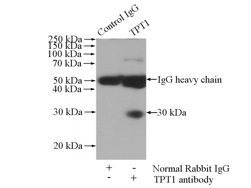 IP Result of anti-TPT1 (IP:Catalog No:116220, 4ug; Detection:Catalog No:116220 1:500) with human placenta tissue lysate 1520ug.