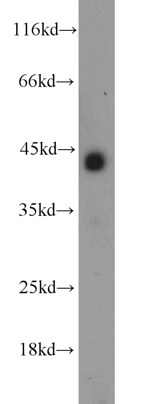 mouse skeletal muscle tissue were subjected to SDS PAGE followed by western blot with Catalog No:111656(IL10RB antibody) at dilution of 1:300