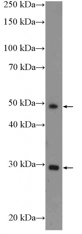 Jurkat cells were subjected to SDS PAGE followed by western blot with Catalog No:111595(ICOS Antibody) at dilution of 1:300