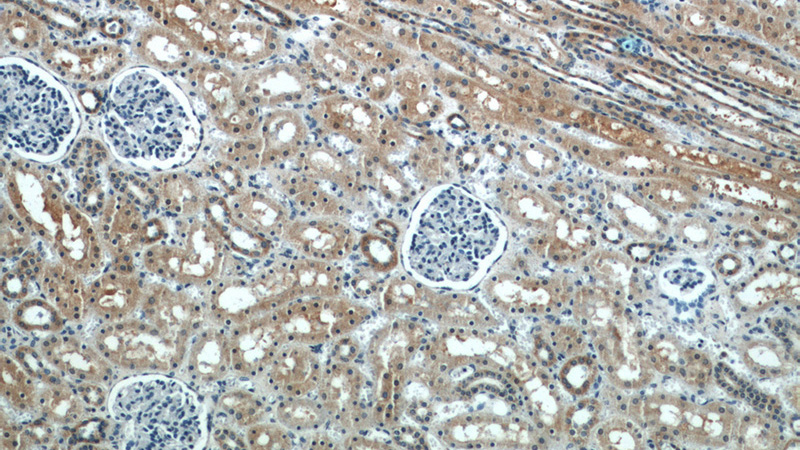 Immunohistochemical of paraffin-embedded human kidney using Catalog No:113774(PFTK1 antibody) at dilution of 1:100 (under 10x lens)