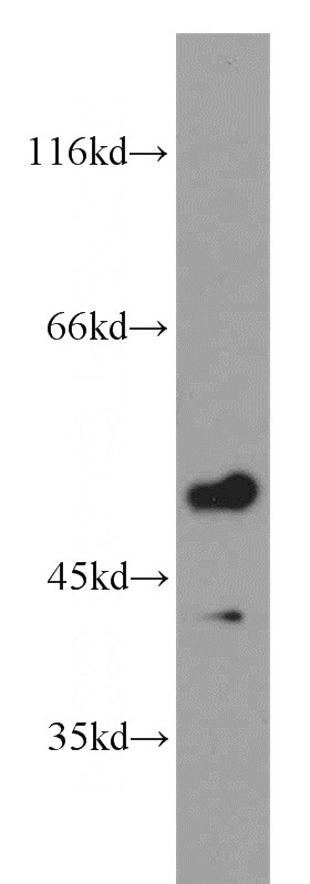human brain tissue were subjected to SDS PAGE followed by western blot with Catalog No:114930(RRP8 antibody) at dilution of 1:1500