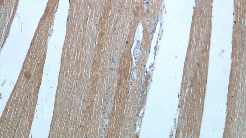 Immunohistochemical of paraffin-embedded human skeletal muscle using Catalog No:113927(PLA2G4E antibody) at dilution of 1:50 (under 10x lens)