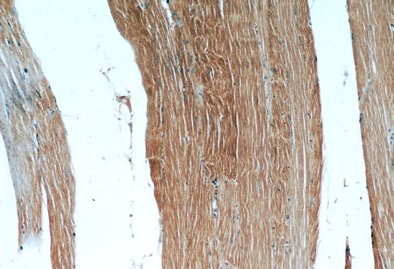 Immunohistochemical of paraffin-embedded human skeletal muscle using Catalog No:112426(MAP4K4 antibody) at dilution of 1:50 (under 10x lens)