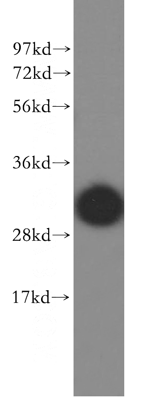 human brain tissue were subjected to SDS PAGE followed by western blot with Catalog No:112999(MYOZ2 antibody) at dilution of 1:400