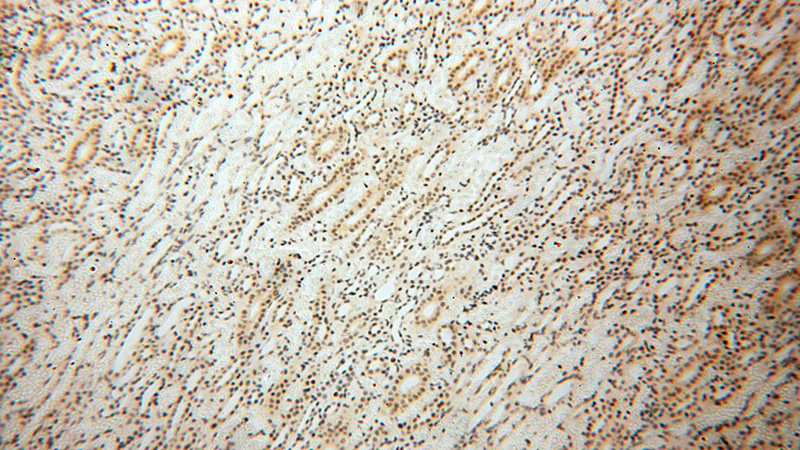 Immunohistochemical of paraffin-embedded human kidney using Catalog No:115603(SRY antibody) at dilution of 1:100 (under 10x lens)