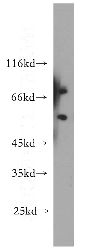 A375 cells were subjected to SDS PAGE followed by western blot with Catalog No:114525(RAG2 antibody) at dilution of 1:300