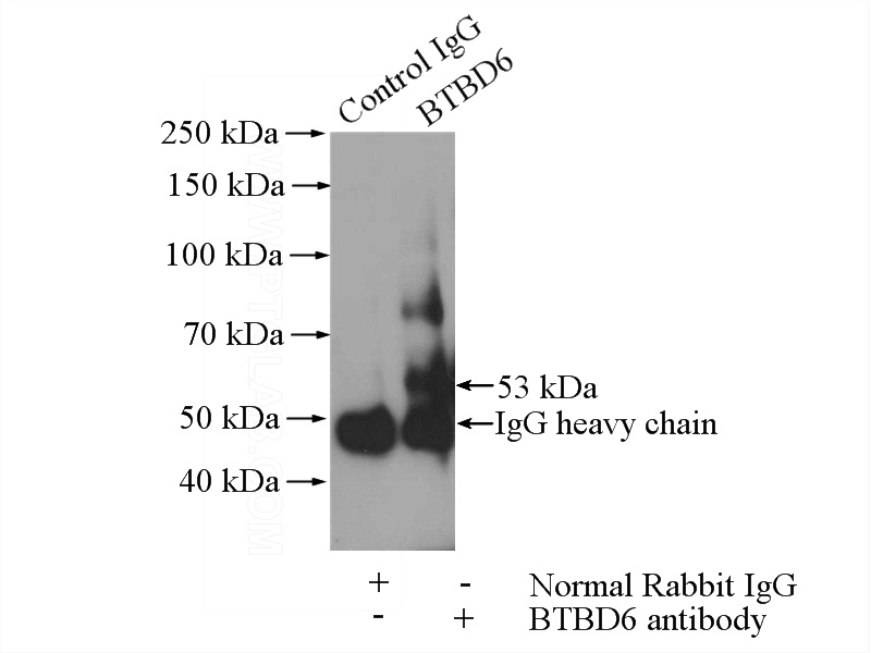 IP Result of anti-BTBD6 (IP:Catalog No:108537, 4ug; Detection:Catalog No:108537 1:300) with Y79 cells lysate 800ug.
