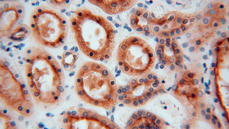 Immunohistochemical of paraffin-embedded human kidney using Catalog No:108314(ATP6V1G1 antibody) at dilution of 1:100 (under 40x lens)