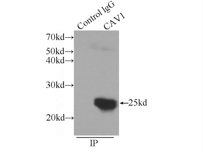 IP Result of anti-Caveolin-1 (IP:Catalog No:108895, 3ug; Detection:Catalog No:108895 1:500) with A549 cells lysate 1200ug.