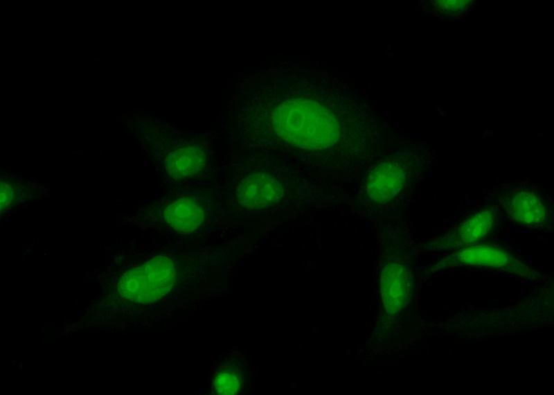 Immunofluorescent analysis of (10% Formaldehyde) fixed HeLa cells using Catalog No:113815(PHF6 Antibody) at dilution of 1:50 and Alexa Fluor 488-congugated AffiniPure Goat Anti-Rabbit IgG(H+L)