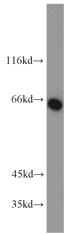 HepG2 cells were subjected to SDS PAGE followed by western blot with Catalog No:108851(CPA6 antibody) at dilution of 1:500