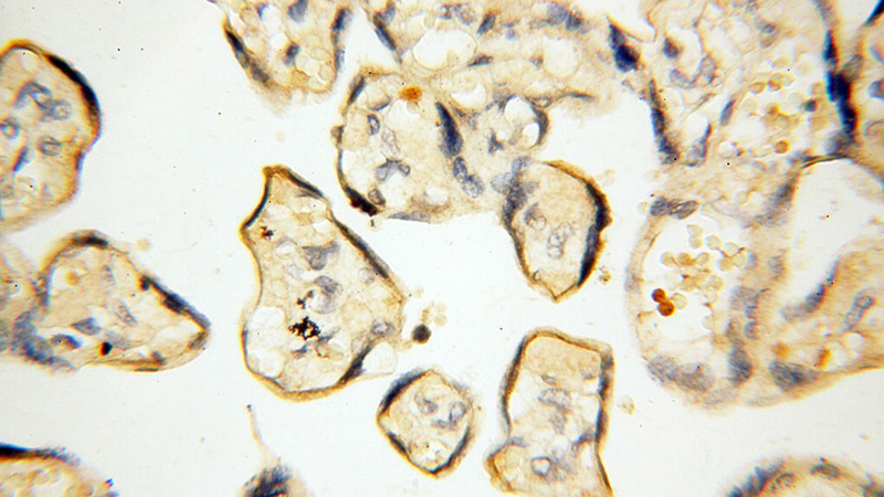Immunohistochemical of paraffin-embedded human placenta using Catalog No:112708(MMP8 antibody) at dilution of 1:100 (under 40x lens)