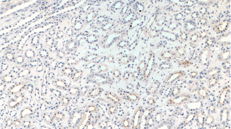 Immunohistochemistry of paraffin-embedded human kidney tissue slide using Catalog No:113195(SLC12A1 Antibody) at dilution of 1:200 (under 10x lens).