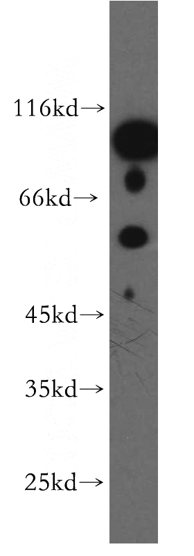 HeLa cells were subjected to SDS PAGE followed by western blot with Catalog No:109904(DGCR2 antibody) at dilution of 1:300