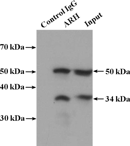 IP Result of anti-LDLRAP1 (IP:Catalog No:108257, 4ug; Detection:Catalog No:108257 1:1000) with HEK-293 cells lysate 3000ug.