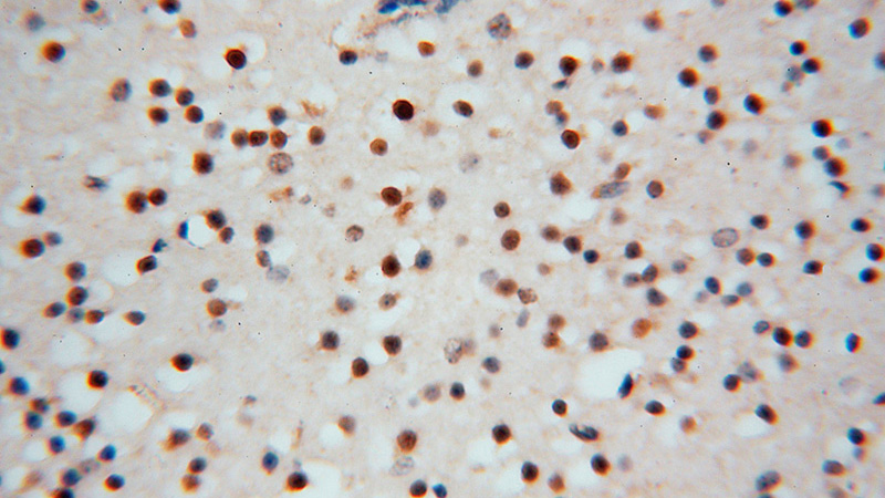 Immunohistochemical of paraffin-embedded human brain using Catalog No:114731(RNASEH2C antibody) at dilution of 1:50 (under 40x lens)