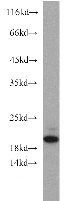 Jurkat cells were subjected to SDS PAGE followed by western blot with Catalog No:108170(ARPP-19 antibody) at dilution of 1:500
