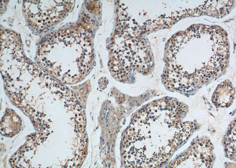 Immunohistochemistry of paraffin-embedded human testis tissue slide using Catalog No:108027(APOBEC3G Antibody) at dilution of 1:200 (under 10x lens).