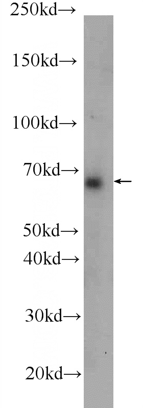 Hela cells were subjected to SDS PAGE followed by western blot with Catalog No:108061(ANKLE1 Antibody) at dilution of 1:500