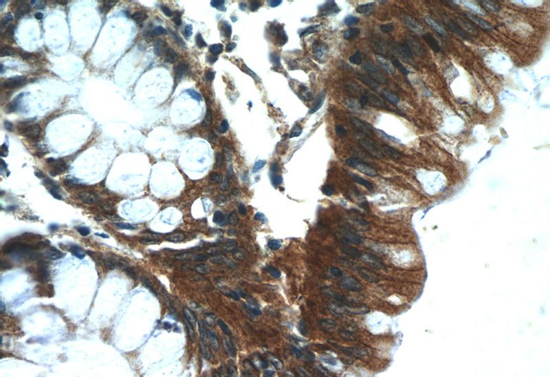 Immunohistochemistry of paraffin-embedded human colon tissue slide using Catalog No:113343(OPHN1 Antibody) at dilution of 1:50 (under 40x lens)