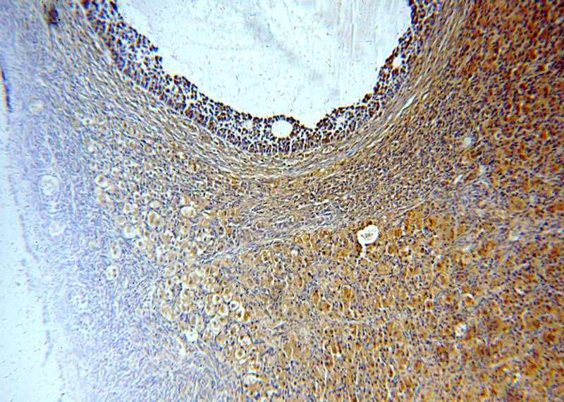 Immunohistochemical of paraffin-embedded human ovary using Catalog No:108543(BTG4 antibody) at dilution of 1:50 (under 10x lens)