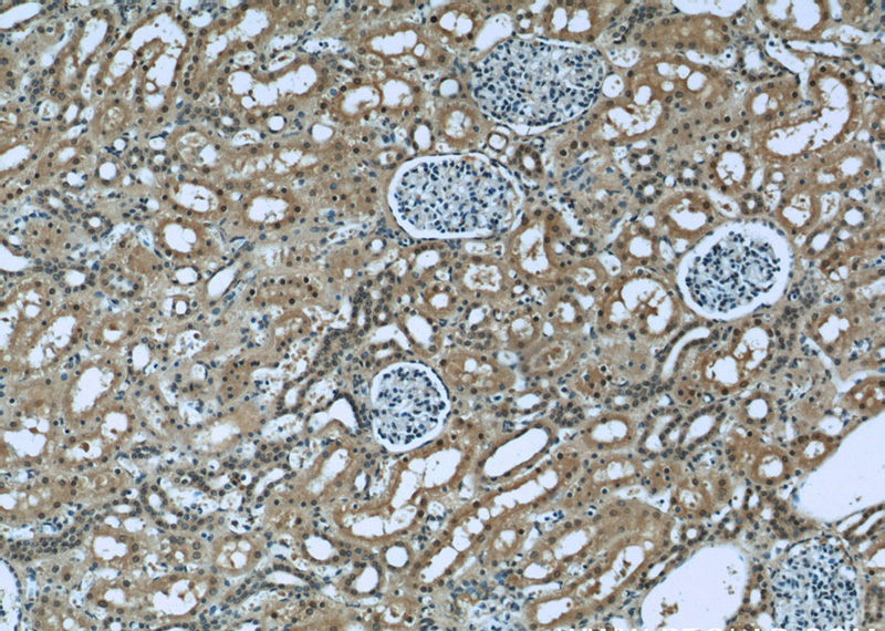 Immunohistochemistry of paraffin-embedded human kidney slide using Catalog No:107505(RENALASE Antibody) at dilution of 1:50