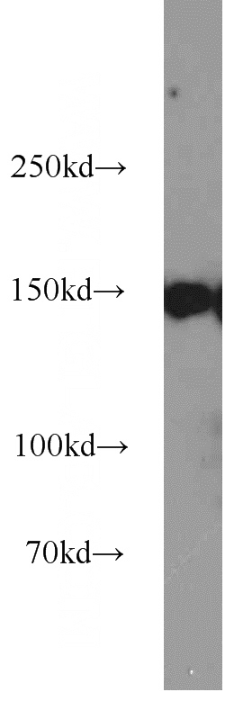 Jurkat cells were subjected to SDS PAGE followed by western blot with Catalog No:109207(CHAF1A antibody) at dilution of 1:2000