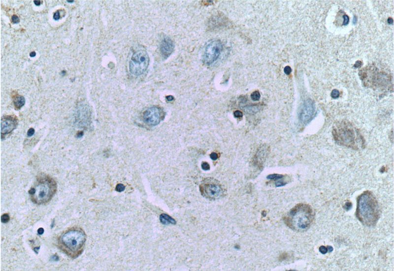Immunohistochemistry of paraffin-embedded human brain tissue slide using Catalog No:115857(TAU Antibody) at dilution of 1:200 (under 40x lens)
