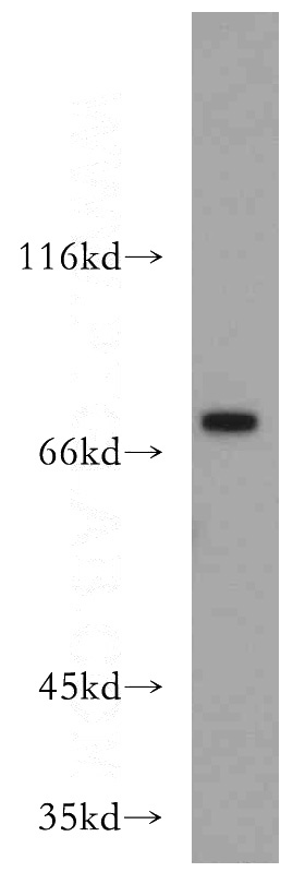 human kidney tissue were subjected to SDS PAGE followed by western blot with Catalog No:117273(ZXDC antibody) at dilution of 1:300