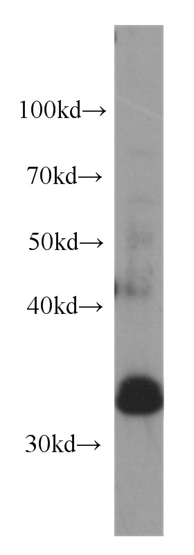 PC-3 cells were subjected to SDS PAGE followed by western blot with Catalog No:107423(MEST antibody) at dilution of 1:1000