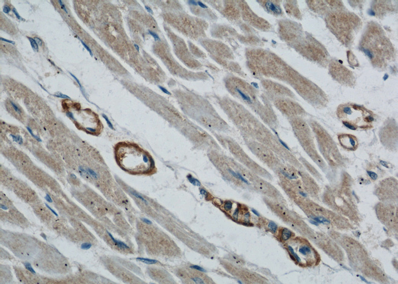 Immunohistochemical of paraffin-embedded human heart using Catalog No:116239(TOM70 antibody) at dilution of 1:50 (under 40x lens)