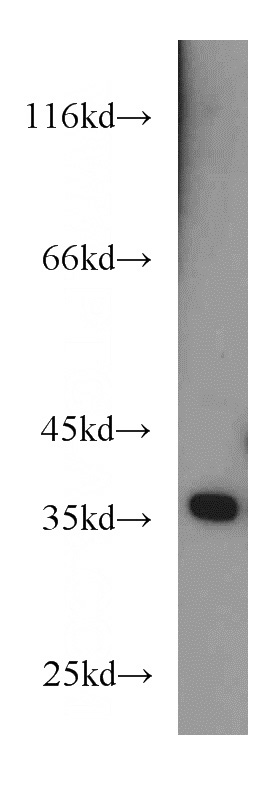 mouse brain tissue were subjected to SDS PAGE followed by western blot with Catalog No:114162(PQBP1 antibody) at dilution of 1:500