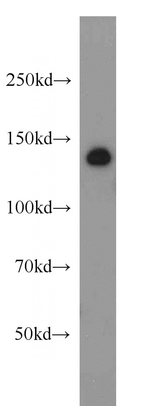 HeLa cells were subjected to SDS PAGE followed by western blot with Catalog No:107796(ADNP antibody) at dilution of 1:1000