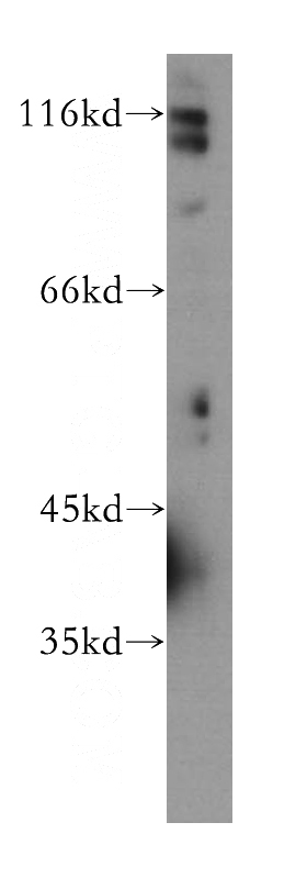 COLO 320 cells were subjected to SDS PAGE followed by western blot with Catalog No:107242(DSE antibody) at dilution of 1:300