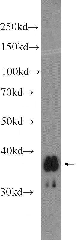 fetal human brain tissue were subjected to SDS PAGE followed by western blot with Catalog No:116548(SLC25A14 Antibody) at dilution of 1:300