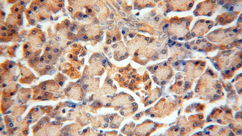 Immunohistochemical of paraffin-embedded human pancreas using Catalog No:108245(ARF3 antibody) at dilution of 1:50 (under 40x lens)