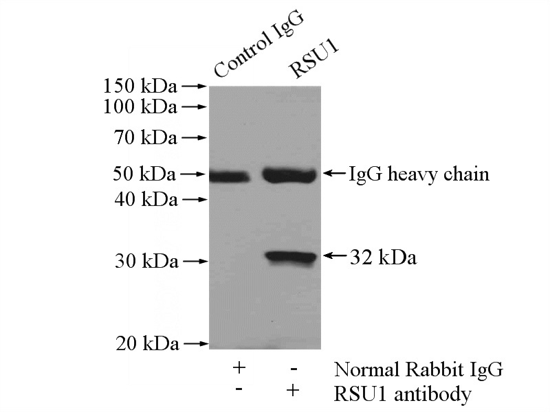 IP Result of anti-RSU1 (IP:Catalog No:114854, 4ug; Detection:Catalog No:114854 1:300) with human placenta tissue lysate 1520ug.