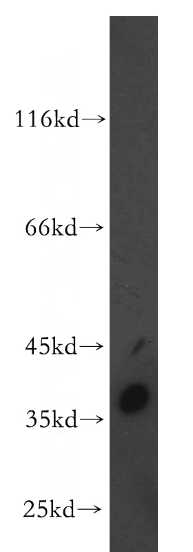 human testis tissue were subjected to SDS PAGE followed by western blot with Catalog No:109732(C1QTNF1 antibody) at dilution of 1:500