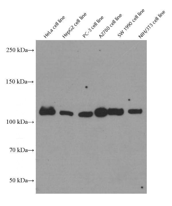 Various cells were subjected to SDS PAGE followed by western blot with Catalog No:117346(Vinculin Antibody) at dilution of 1:5000