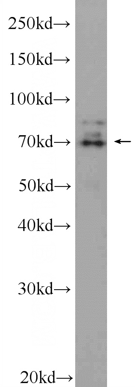 K-562 cells were subjected to SDS PAGE followed by western blot with Catalog No:115003(SCML2 Antibody) at dilution of 1:300