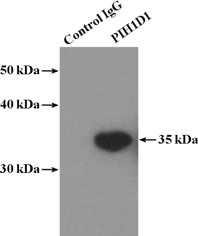 IP Result of anti-PIH1D1 (IP:Catalog No:113900, 4ug; Detection:Catalog No:113900 1:1000) with HeLa cells lysate 1200ug.
