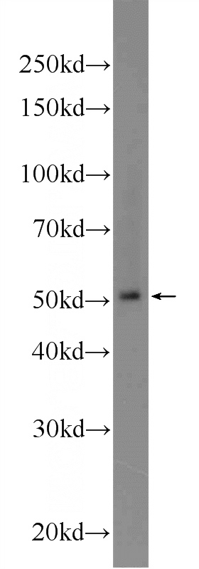 MCF-7 cells were subjected to SDS PAGE followed by western blot with Catalog No:108550(BTNL8 Antibody) at dilution of 1:600