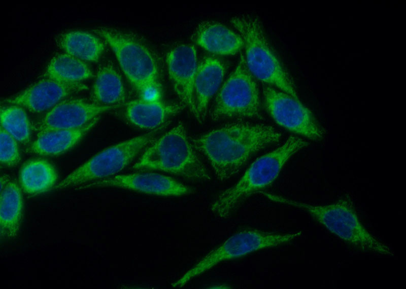 Immunofluorescent analysis of (10% Formaldehyde) fixed HeLa cells using Catalog No:110647(FH Antibody) at dilution of 1:50 and Alexa Fluor 488-congugated AffiniPure Goat Anti-Rabbit IgG(H+L)