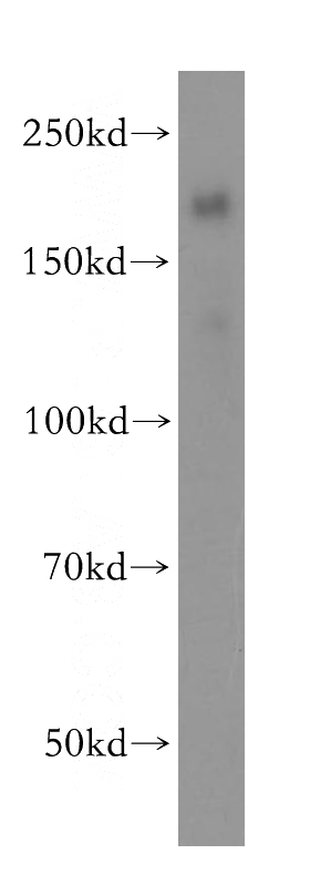 human placenta tissue were subjected to SDS PAGE followed by western blot with Catalog No:113183(NID2 antibody) at dilution of 1:400