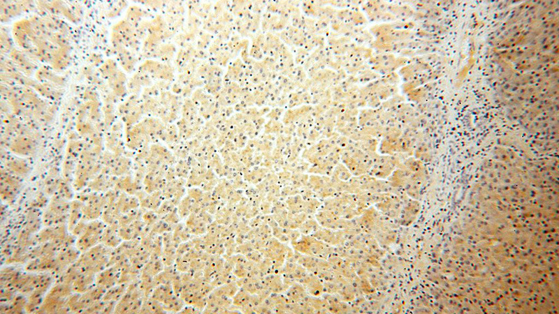 Immunohistochemical of paraffin-embedded human liver using Catalog No:110791(FUCA2 antibody) at dilution of 1:100 (under 10x lens)